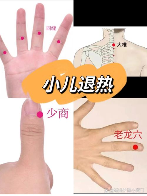 婴儿高烧的穴位疗法