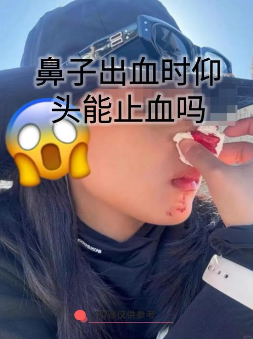 脑梗鼻子出血有危害吗