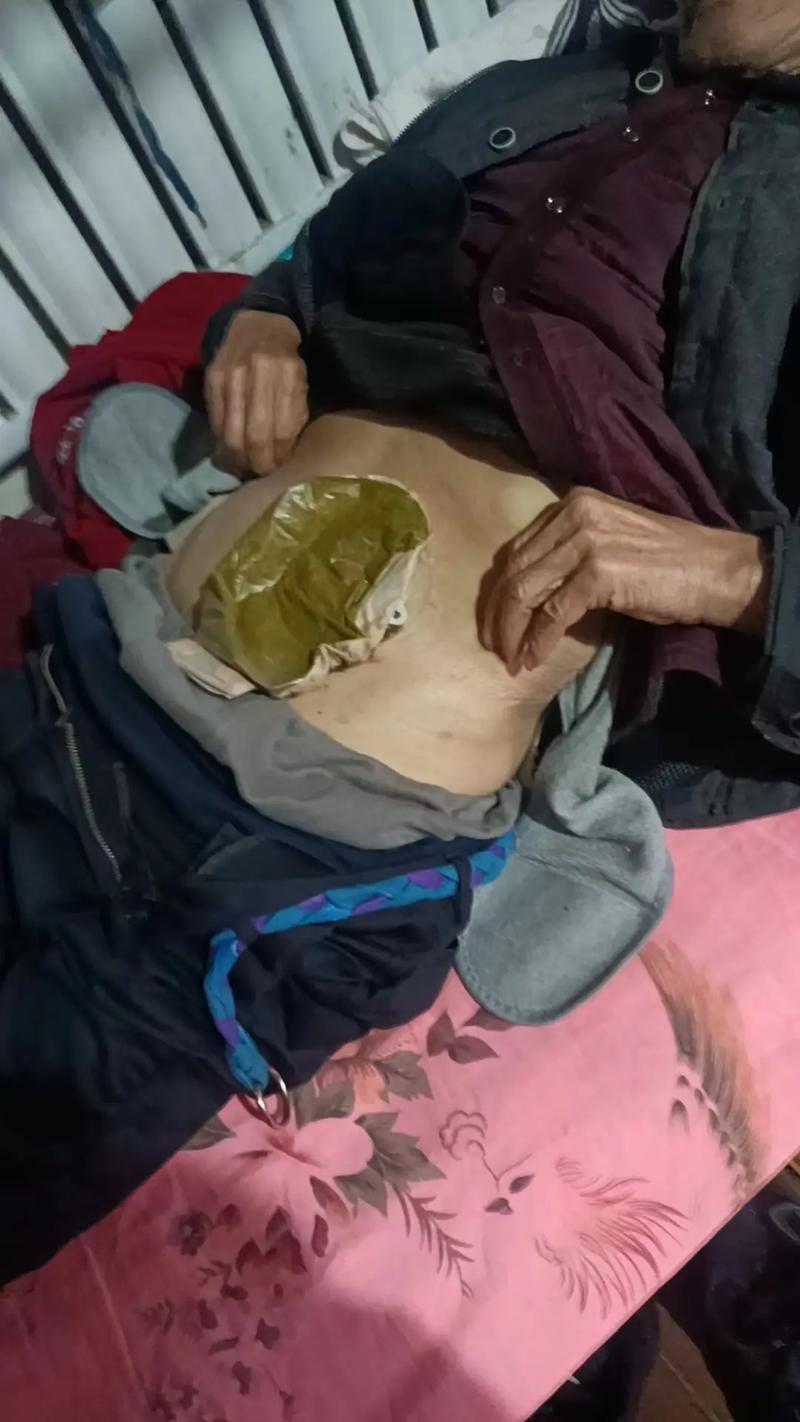 成都风湿病医院 垃圾