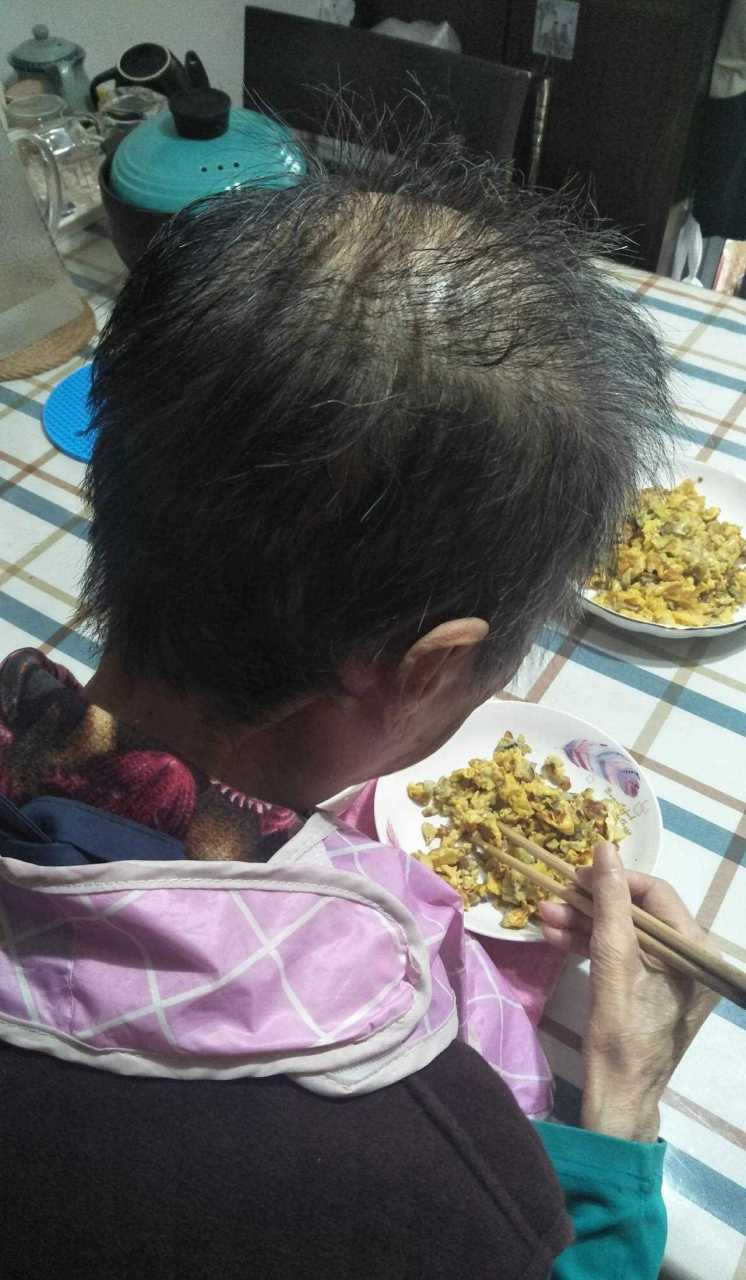 脑梗病人把家人折腾死