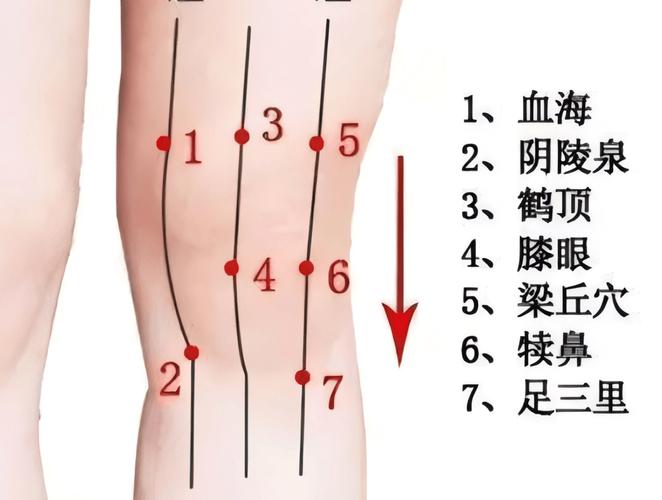 关节炎 艾灸 穴位