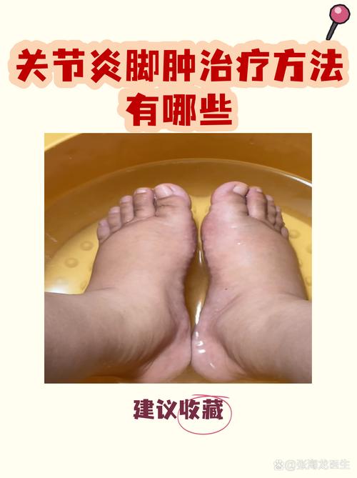 风湿肿用冷水还是热水