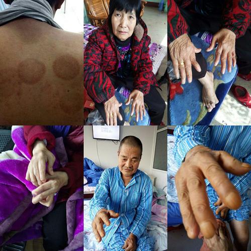 石家庄燕赵医院类风湿