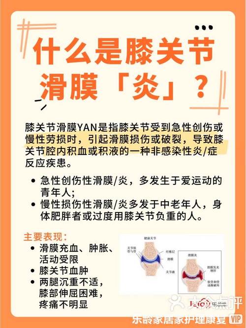 年轻膝盖风湿怎么治疗