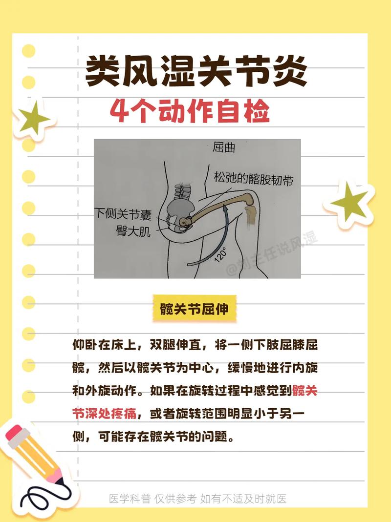 风湿关节肿大怎么治疗