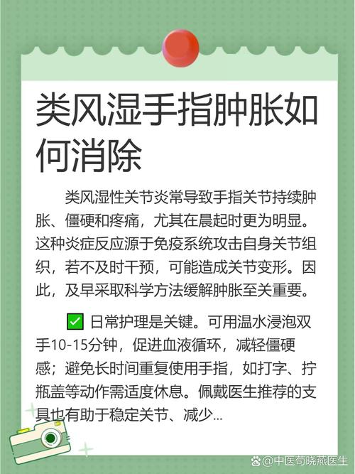 风湿手疼怎么缓解疼痛