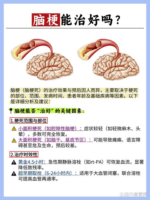 脑梗能治好吗多长时间