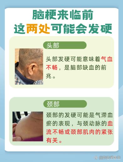 脑梗的先兆有哪些症状