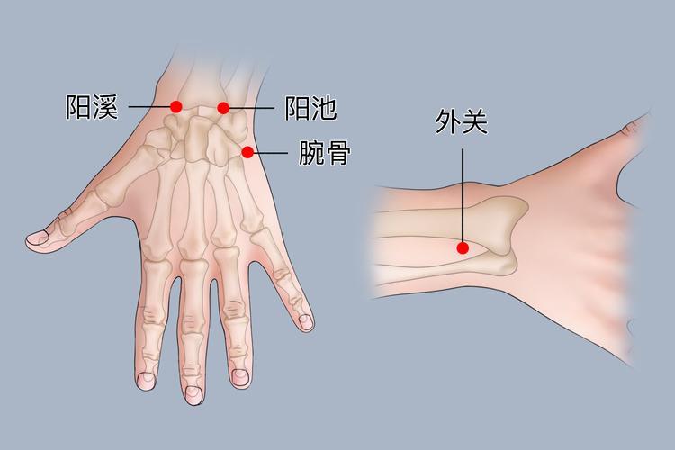 手腕拉伤按哪个穴位