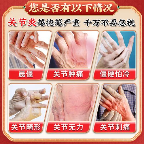 手关节风湿用什么药膏