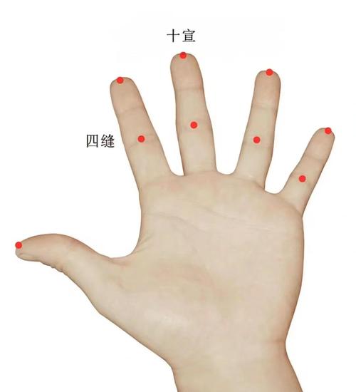 晕车扎什么穴位最好