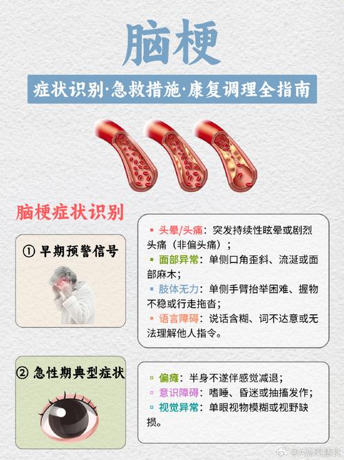 脑梗脾气暴躁治疗方法