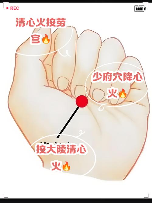 推拿哪个穴位去心火