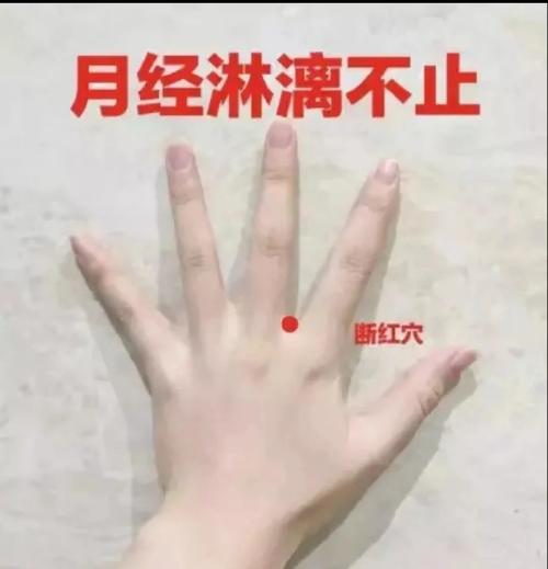 妇科止血穴位有哪些