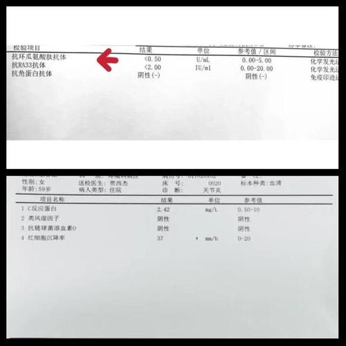 做什么检查能确诊风湿