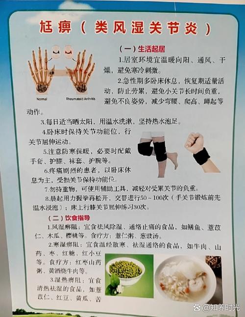 轻度类风湿可以自愈吗