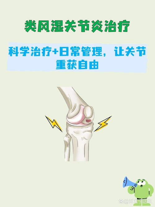 类风湿合理用激素治疗