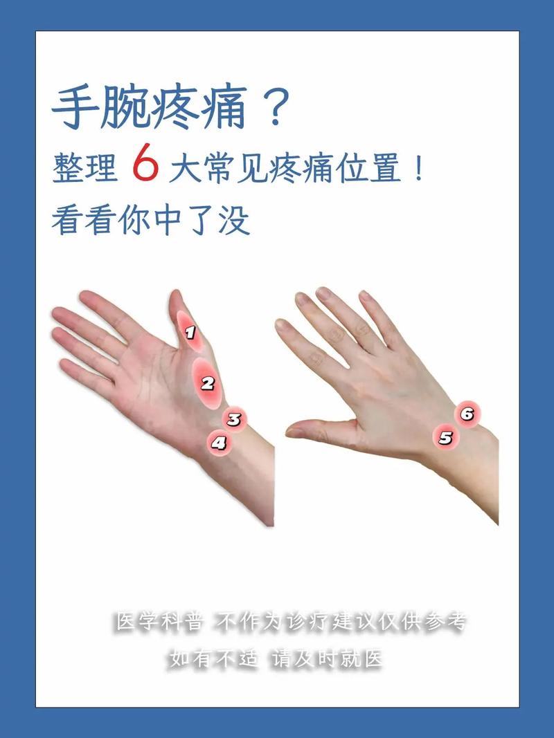 手腕疼是风湿还是痛风