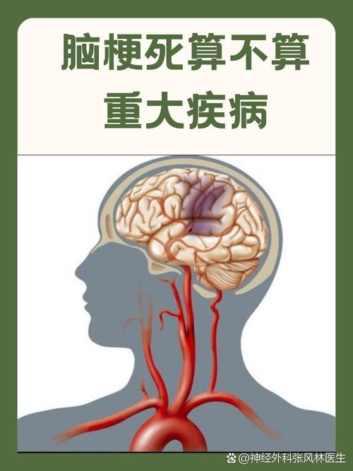 脑梗最严重是什么后果