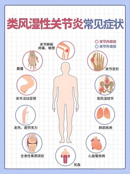 类风湿因子受什么影响