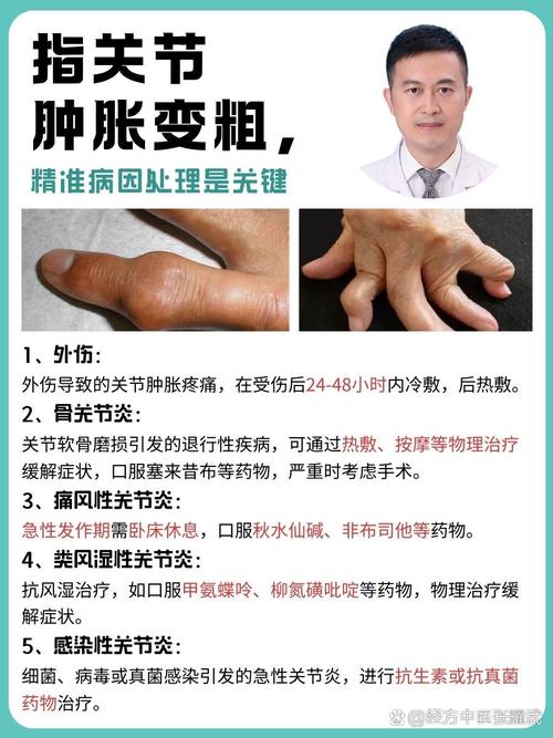 得了类风湿多久会病变