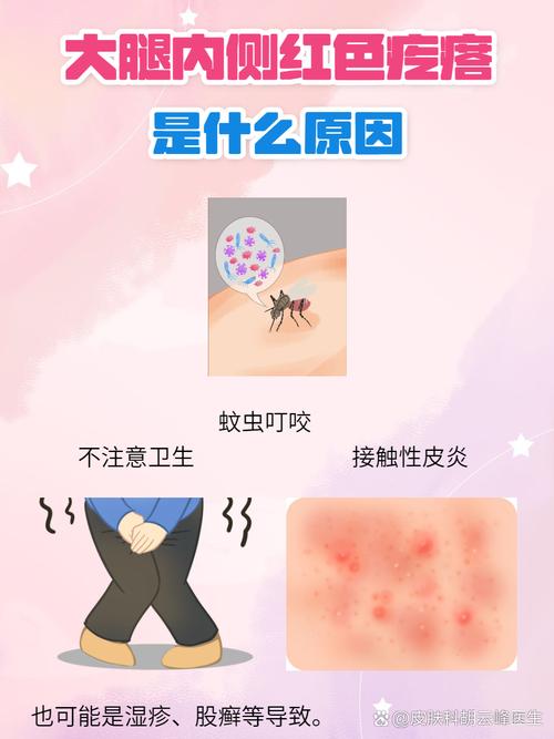 产后风湿疙瘩怎么回事