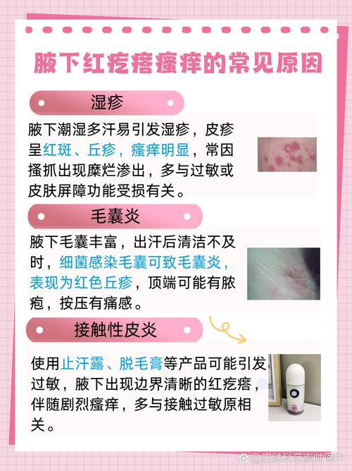 产后风湿疙瘩怎么回事