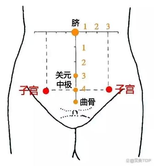 子宫穴位位置在哪里