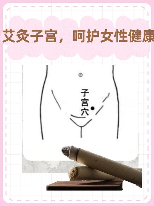 子宫穴位位置在哪里