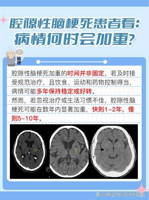 右侧额叶腔梗是脑梗吗
