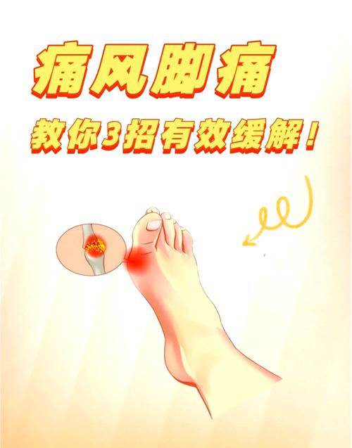 脚掌风湿肿痛怎么治疗