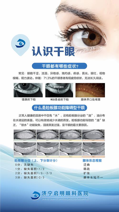 干眼症与风湿有关系吗