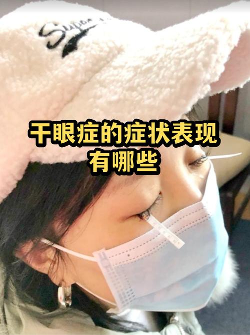 干眼症与风湿有关系吗