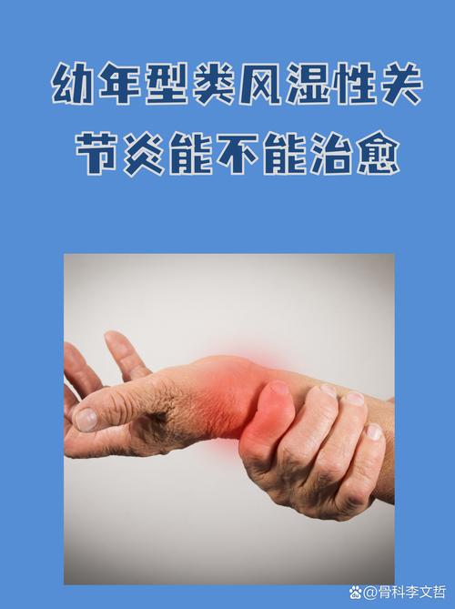 产后风湿什么时候发作