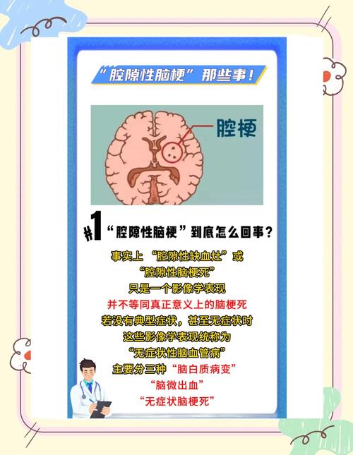 脑梗的发病症状有哪些