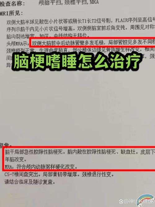 脑梗后嗜睡是什么原因