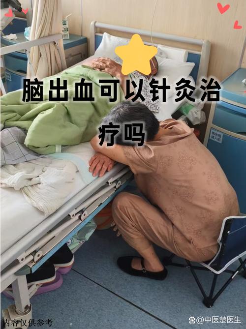 脑梗急救方法针刺放血