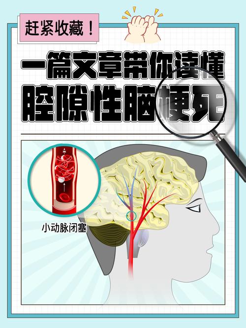 腔隙性脑梗影响寿命吗
