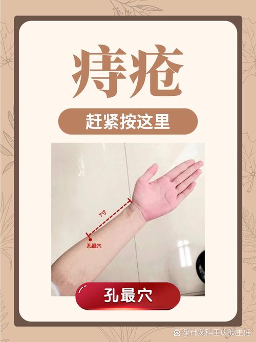 用什么穴位治疗痔疮