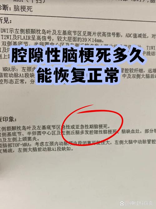 腔隙性脑梗多久能恢复