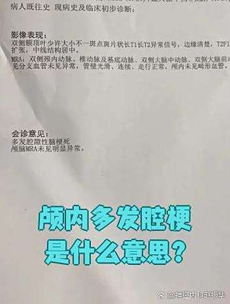 脑内多发腔梗灶严重吗