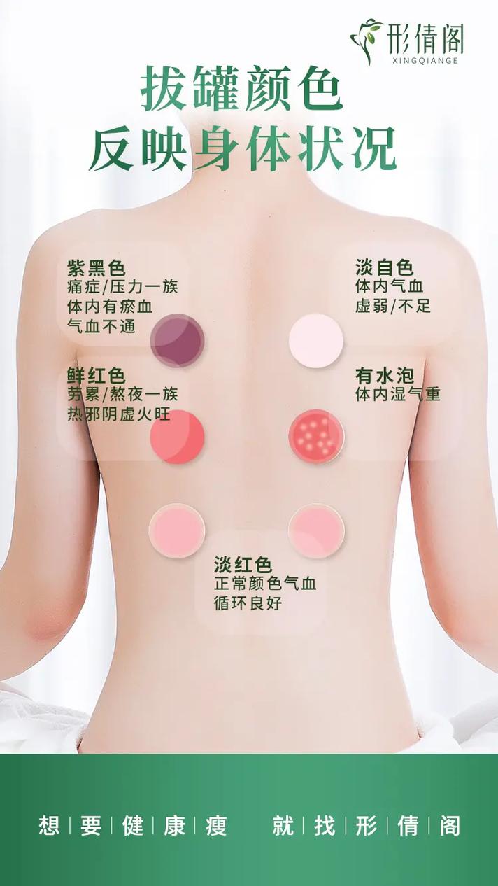 后背穴位在什么位置