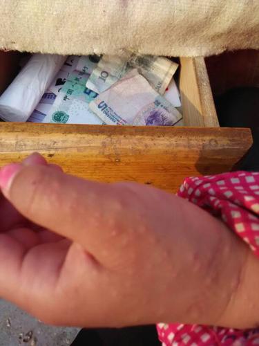 婴儿风湿疙瘩注意事项