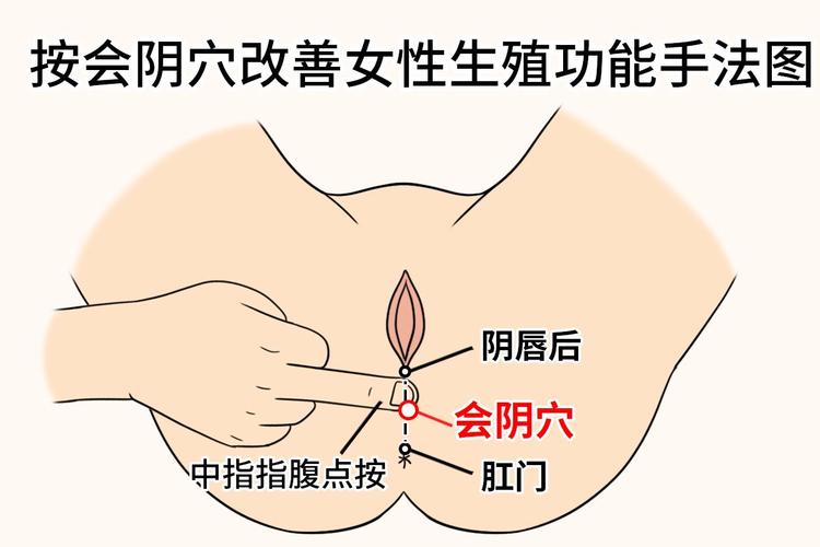 针灸穴位会阴穴图片