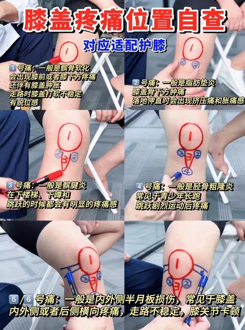 风湿膝盖痛火罐拔哪里