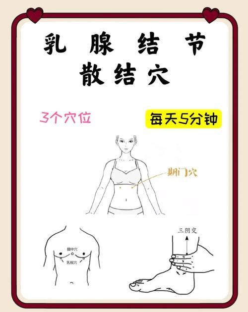 哪个穴位对乳房硬块