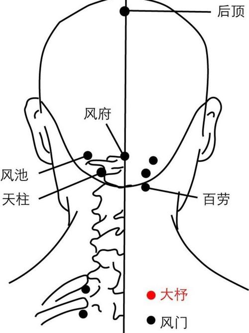 脖子扭了按哪个穴位