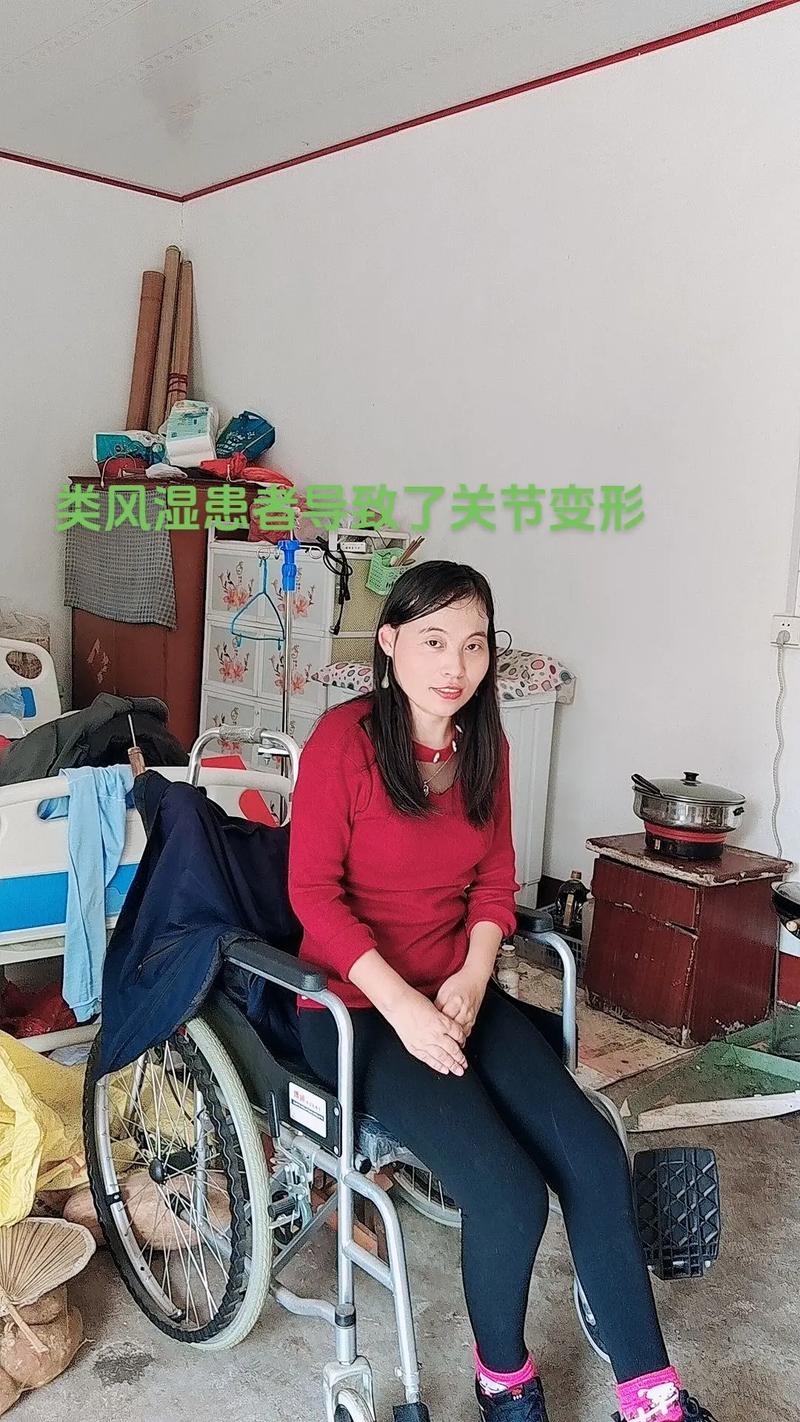 类风湿瘫痪女孩40年