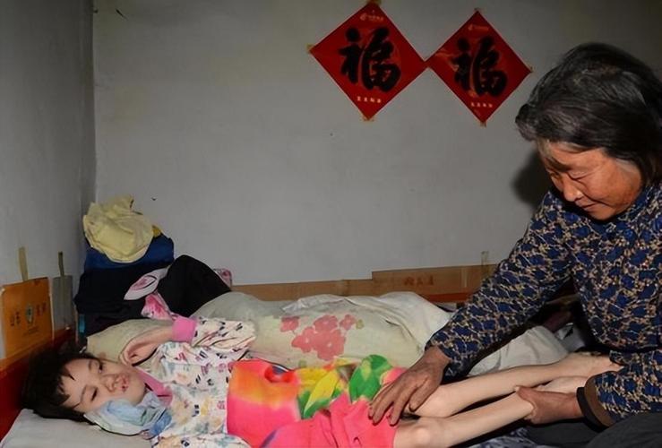 类风湿瘫痪女孩40年