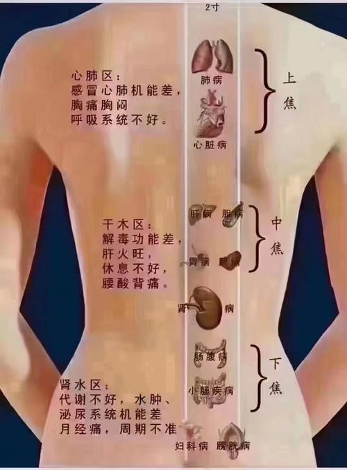 艾炙背部治疗类风湿吗